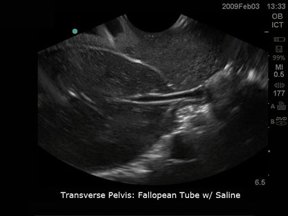 BluePhantom transvaginal ultraljudsträningsmodell för sonohysterografi och sonosalpingografi