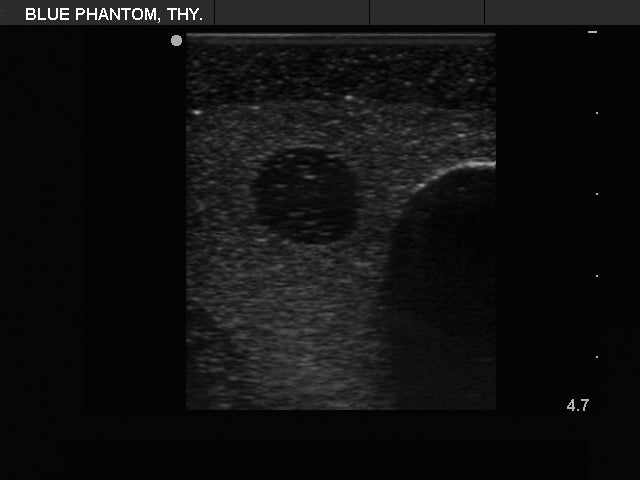 BluePhantom ultraljudsträningsmodell för tyreoideabiopsi