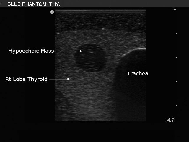BluePhantom ultraljudsträningsmodell för tyreoideabiopsi