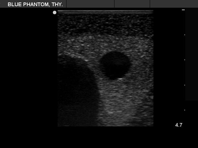 BluePhantom ultraljudsträningsmodell för tyreoideabiopsi