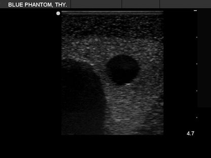 BluePhantom ultraljudsträningsmodell för tyreoideabiopsi