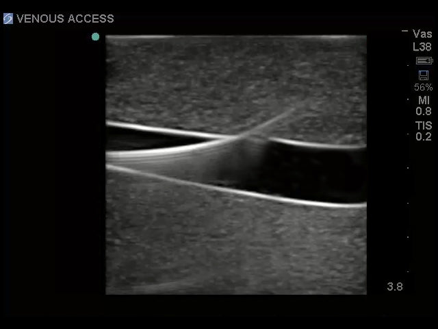 BluePhantom ersättningsvävnad för femoral kärlåtkomst