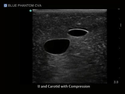 BluePhantom Ultraljudsträningsmodell för CVK-inläggning med transparent insats