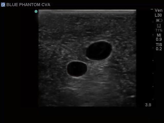 BluePhantom Ultraljudsträningsmodell för CVK-inläggning med transparent insats