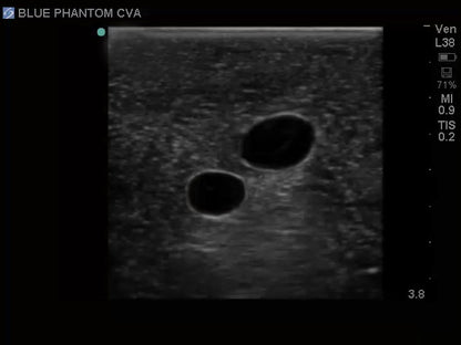 BluePhantom Ultraljudsträningsmodell för CVK-inläggning med transparent insats
