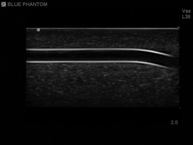 Blue Phantom Ultraljudsträningsblock Pediatrisk 4 kärl